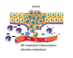 纳米粒子引起的炎症可增加肿瘤恶性程度。,Acta Biomaterialia - X-MOL