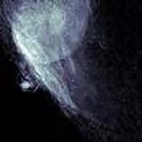 Quantitative ptychographic bio-imaging in the water window,Optics ...