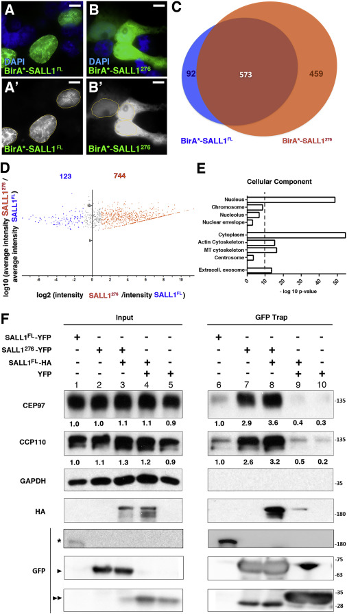 Truncated SALL1 Impedes Primary Cilia Function in Townes-Brocks ...