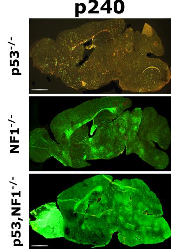 p53 and NF 1 loss plays distinct but complementary roles in glioma ...