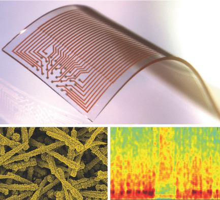 High‐Density Stretchable Electrode Grids for Chronic Neural Recording ...