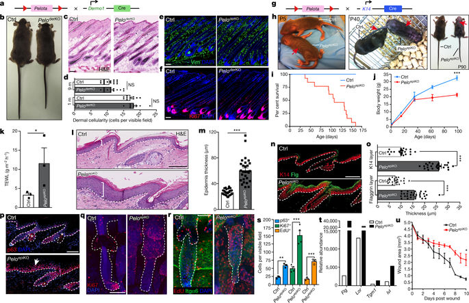 An Evolutionarily Conserved Ribosome rescue Pathway Maintains Epidermal Homeostasis Nature X MOL