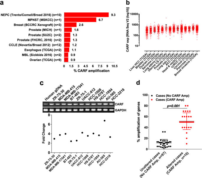 CARF enrichment promotes epithelial-mesenchymal transition via Wnt/β ...