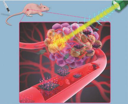 2D Ultrathin MXene‐Based Drug‐Delivery Nanoplatform For Synergistic ...