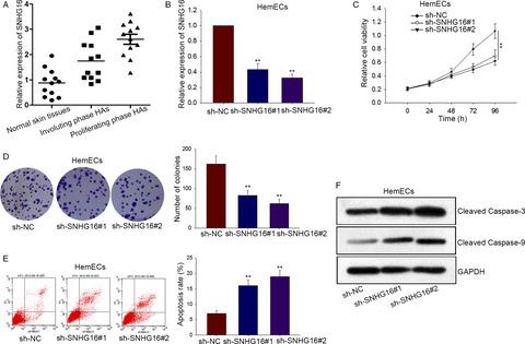 LncRNA SNHG16 drives proliferation, migration, and invasion of ...
