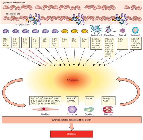 银屑病关节炎的发病机理。,The Lancet - X-MOL