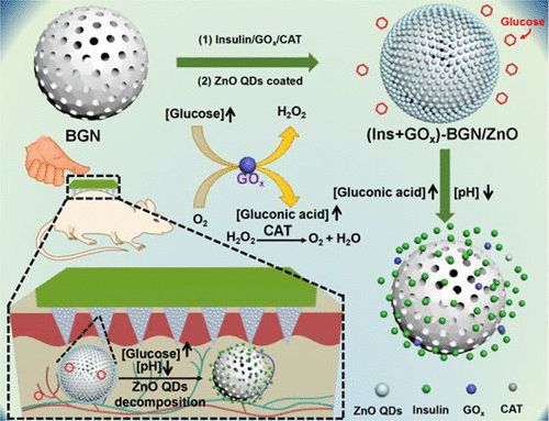 implants containing both glucose oxidase and catalase,... Microneedles Integrated with ZnO Quantum-Dot-Capped Mesoporous ...