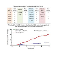 Modified PAGE-B Score Predicts The Risk Of Hepatocellular Carcinoma In ...