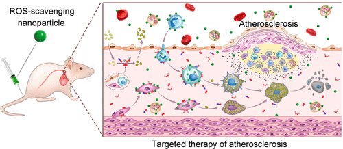 Targeted Therapy of Atherosclerosis by a Broad-Spectrum Reactive Oxygen ...