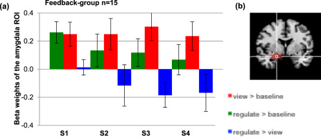 Training Emotion Regulation Through Real Time Fmri Neurofeedback Of Amygdala Activity Neuroimage X Mol