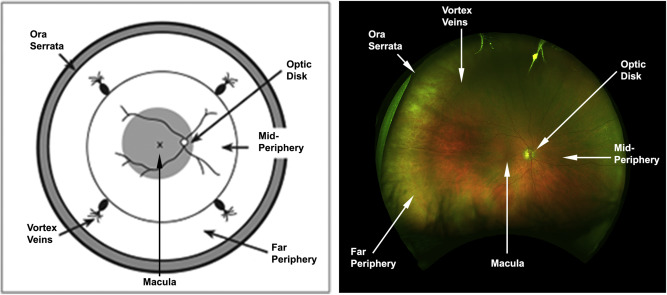 progress in retinal and eye research