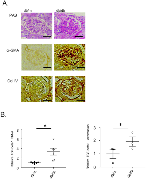 Aberrant Dna Methylation Of Tgfb1 In Diabetic Kidney Mesangial Cells Scientific Reports X Mol
