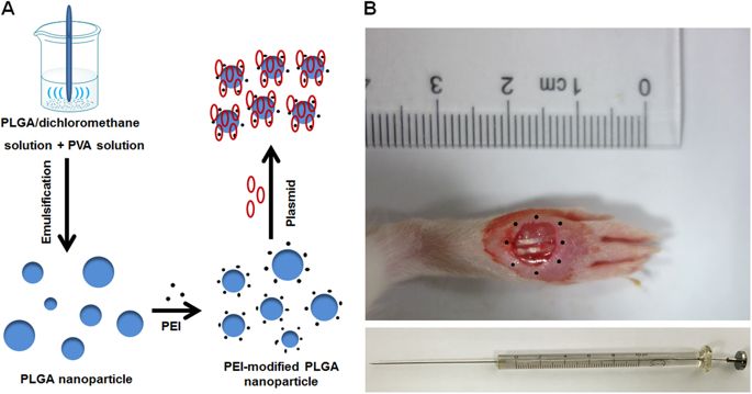 Nanosphere Mediated Co Delivery Of Vegf A And Pdgf B Genes For Accelerating Diabetic Foot Ulcers Healing In Rats Gene Therapy X Mol