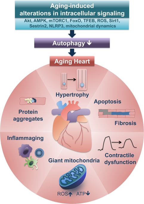 Autophagy Cell Death