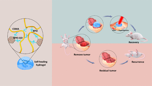 Graphene Nanoparticle Based Self Healing Hydrogel In Preventing Postoperative Recurrence Of Breast Cancer Acs Biomaterials Science Engineering X Mol