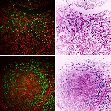 Slide-free imaging of hematoxylin-eosin stained whole-mount