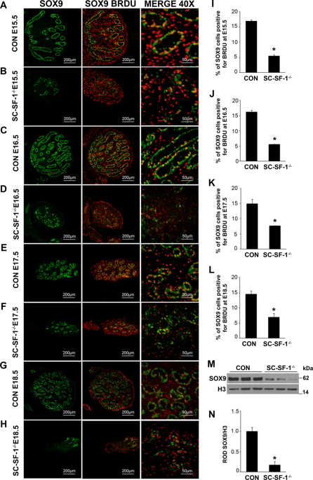 Steroidogenic Factor 1 ( Nr5a1 ) is Required for Sertoli Cell Survival ...