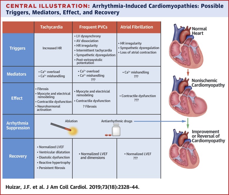 arrhythmia-induced-cardiomyopathy-journal-of-the-american-college-of