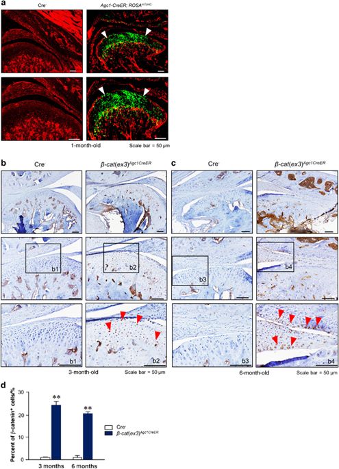 Activation Of B Catenin Signaling In Aggrecan Expressing Cells In Temporomandibular Joint Causes Osteoarthritis Like Defects International Journal Of Oral Science X Mol