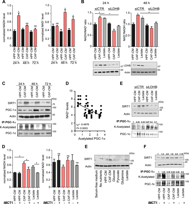 Cancer Associated Fibroblasts Promote Prostate Cancer Malignancy Via Metabolic Rewiring And Mitochondrial Transfer Oncogene X Mol