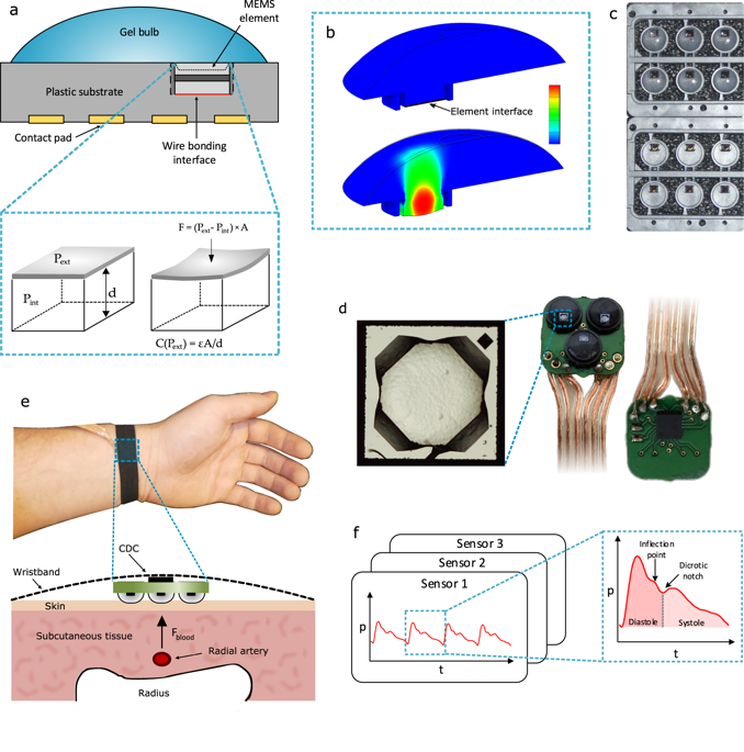 Clinical assessment of a noninvasive wearable MEMS pressure sensor
