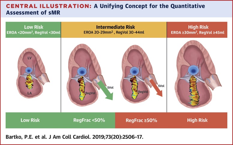 a-unifying-concept-for-the-quantitative-assessment-of-secondary-mitral