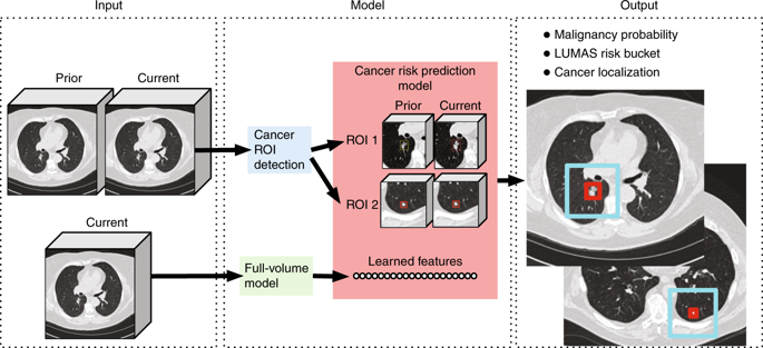 End To End Lung Cancer Screening With Three Dimensional Deep Learning On Low Dose Chest Computed