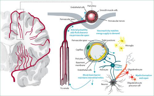 what-is-cerebral-small-vessel-disease-csvd-american-brain-foundation