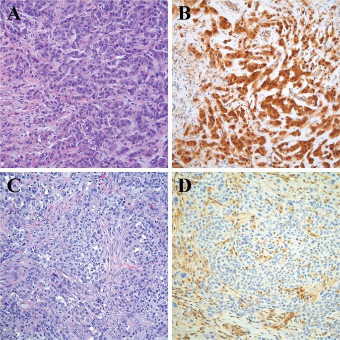 MTAP Immunohistochemistry Is An Accurate And Reproducible Surrogate For ...