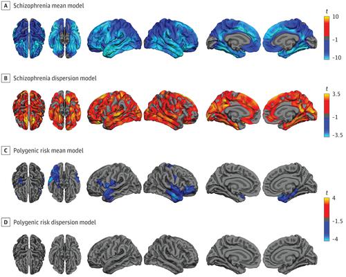 Brain Heterogeneity in Schizophrenia and Its Association With 