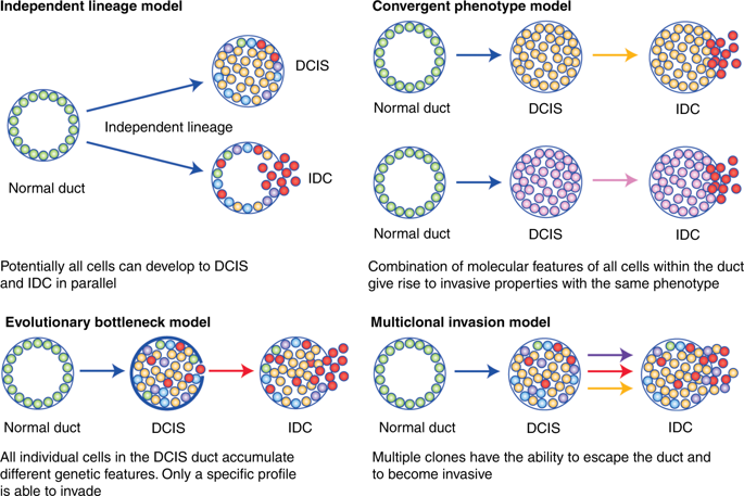 Ductal Carcinoma In Situ To Treat Or Not To Treat That Is The Question British Journal Of Cancer X Mol