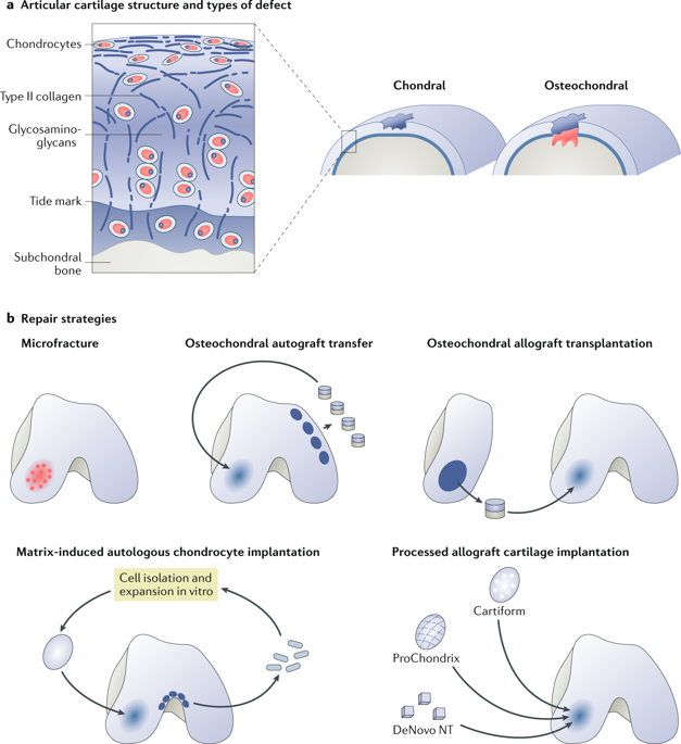 Surgical And Tissue Engineering Strategies For Articular Cartilage And