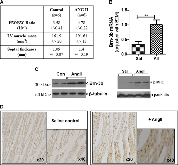 The Pou4f2 Brn 3b Transcription Factor Is Required For The Hypertrophic Response To Angiotensin Ii In The Heart Cell Death Disease X Mol