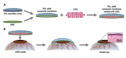 Nanofiber Reinforced Decellularized Amniotic Membrane Improves Limbal Stem Cell Transplantation In A Rabbit Model Of Corneal Epithelial Defect Acta Biomaterialia X Mol