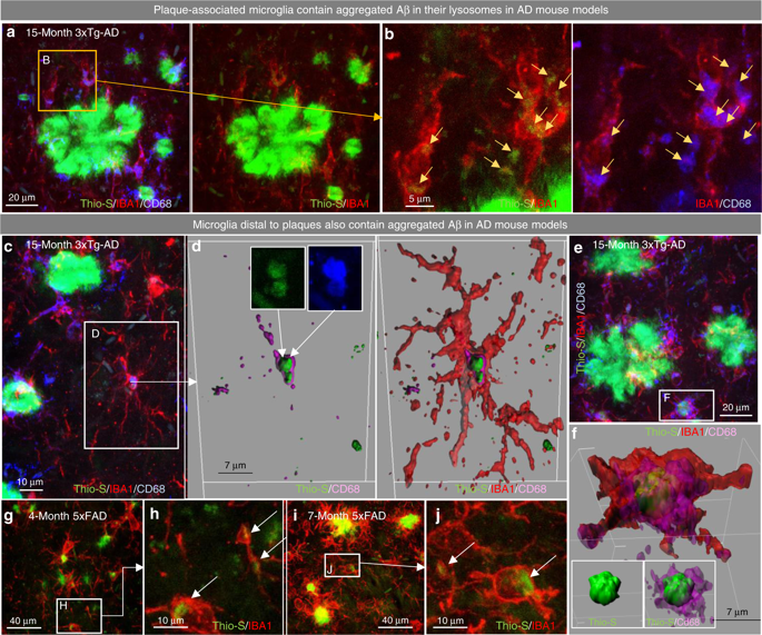 Sustained microglial depletion with CSF1R inhibitor impairs parenchymal ...