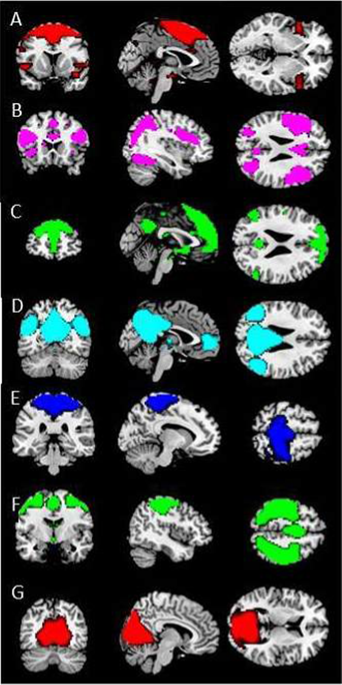 Neural Correlates Of Victimization In Psychosis Differences In Brain Response To Angry Faces Npj Schizophr X Mol