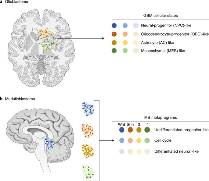 Deciphering Brain Tumor Heterogeneity One Cell At A Time Nature