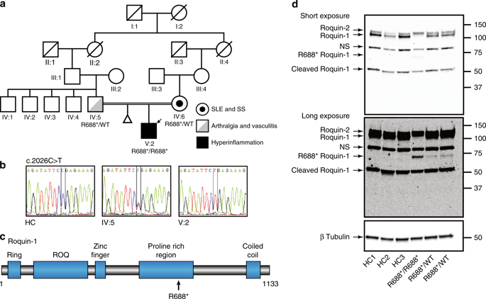 A Human Immune Dysregulation Syndrome Characterized By Severe Hyperinflammation With A Homozygous Nonsense Roquin 1 Mutation Nature Communications X Mol