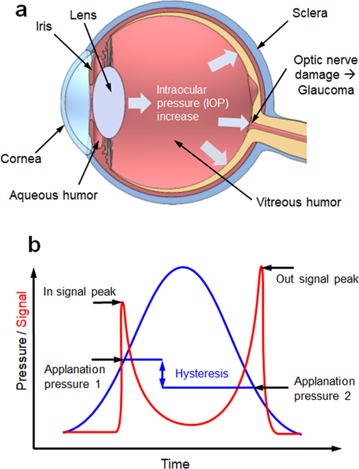 Dual Optical Signal Based Intraocular Pressure Sensing Principle Using Pressure Sensitive Mechanoluminescent Zns Cu Pdms Soft Composite Scientific Reports X Mol