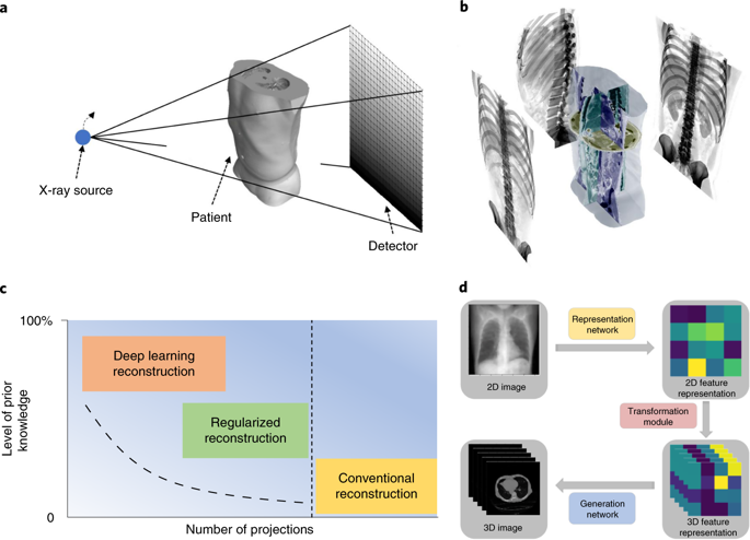 Patient-specific Reconstruction Of Volumetric Computed Tomography ...