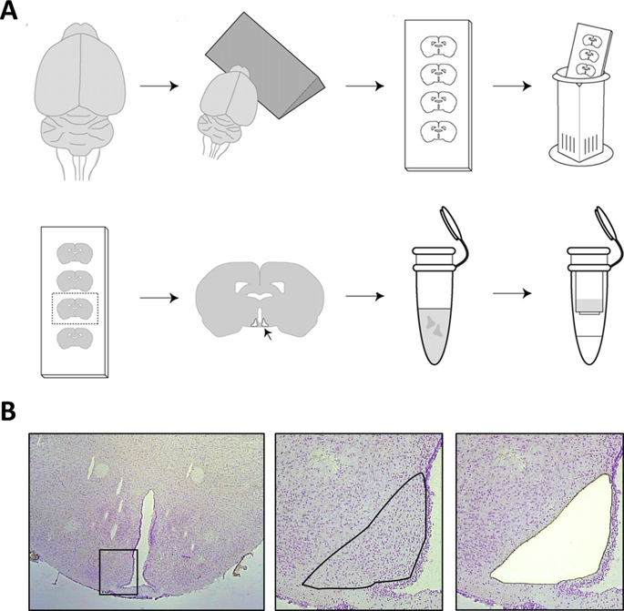 Global transcriptome analysis of rat hypothalamic arcuate nucleus