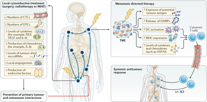 Cytoreductive Treatment Strategies For De Novo Metastatic Prostate Cancer Nature Reviews Clinical Oncology X Mol