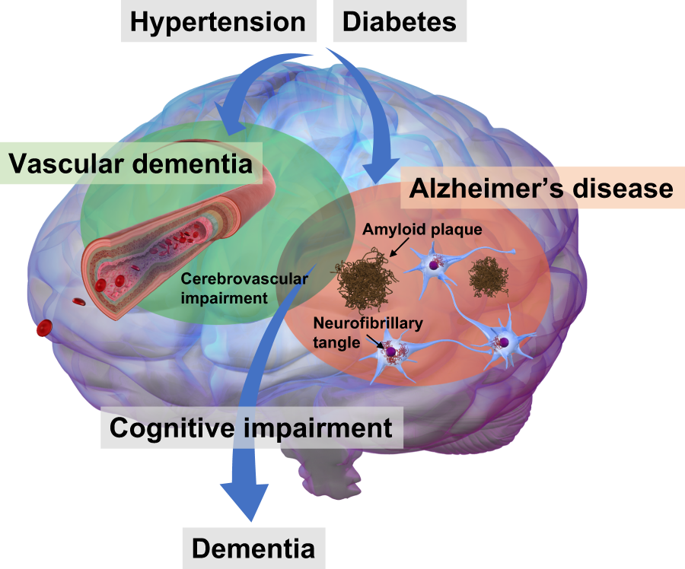 latest research vascular dementia