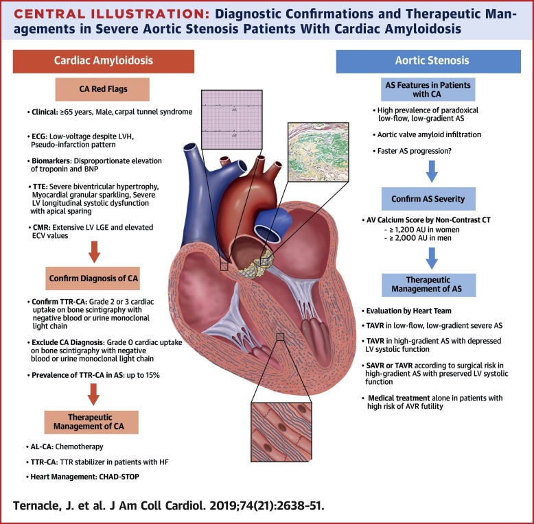 Aortic Stenosis And Cardiac Amyloidosis,Journal Of The American College ...