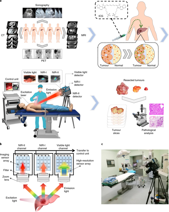 First-in-human Liver-tumour Surgery Guided By Multispectral ...