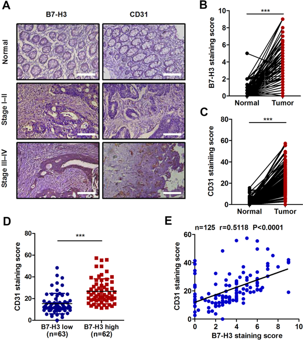 B7-h3 promotes colorectal cancer angiogenesis through activating the nf