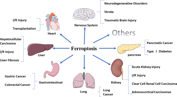 Ferroptosis：过去，现在和未来。,Cell Death & Disease - X-MOL