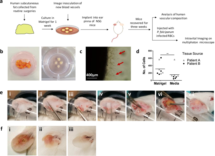 在小鼠耳廓中建立人类脉管系统的异种移植模型 Scientific Reports X Mol