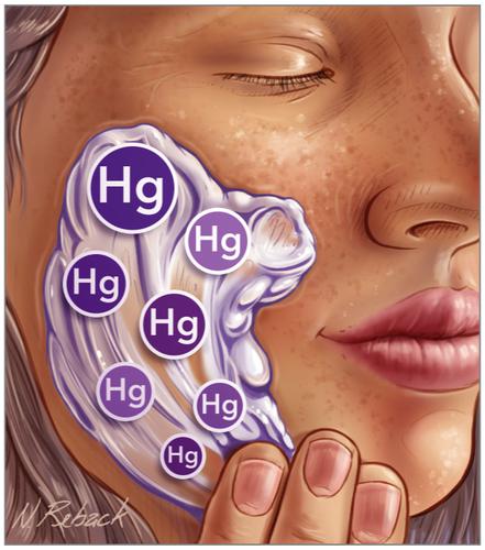 Mercury Poisoning From Skin Cream JAMA X MOL