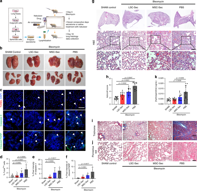 Inhalation Of Lung Spheroid Cell Secretome And Exosomes Promotes Lung ...